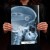 Rentgen X-ray Opel Astra H