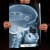 Rentgen X-ray Opel Astra H