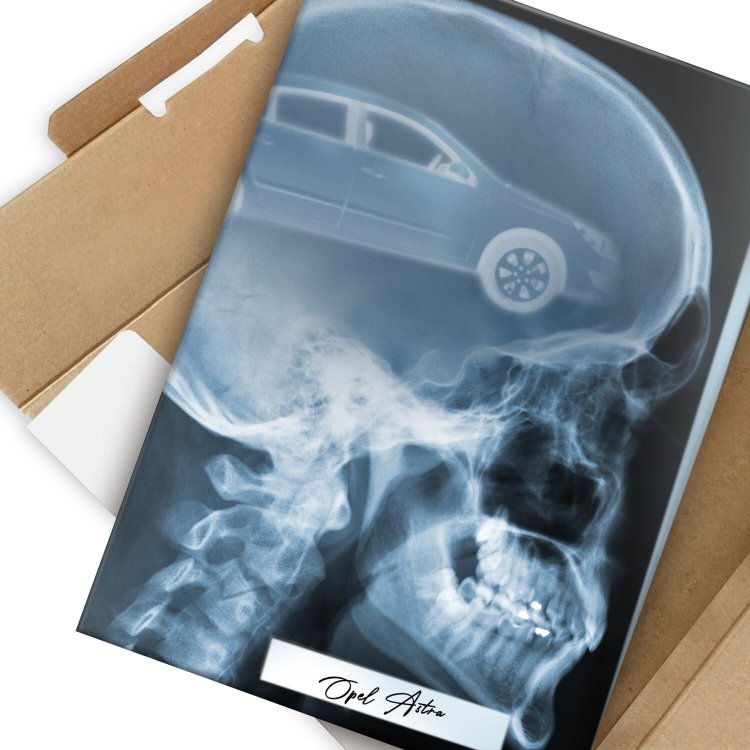 Rentgen X-ray Opel Astra H