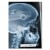 Rentgen X-ray X-ray VW Golf III
