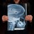 Rentgen X-ray X-ray VW Golf III