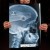 Rentgen X-ray X-ray VW Golf III