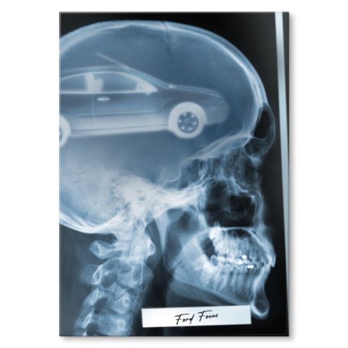 Rentgen X-ray Ford Focus II