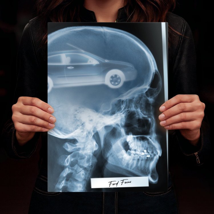 Rentgen X-ray Ford Focus II