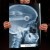 Rentgen X-ray Ford Focus II