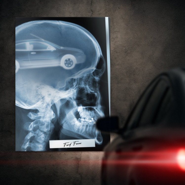 Rentgen X-ray Ford Focus II