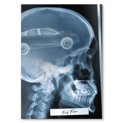Rentgen X-ray Ford Focus III