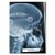 Rentgen X-ray Ford Focus III