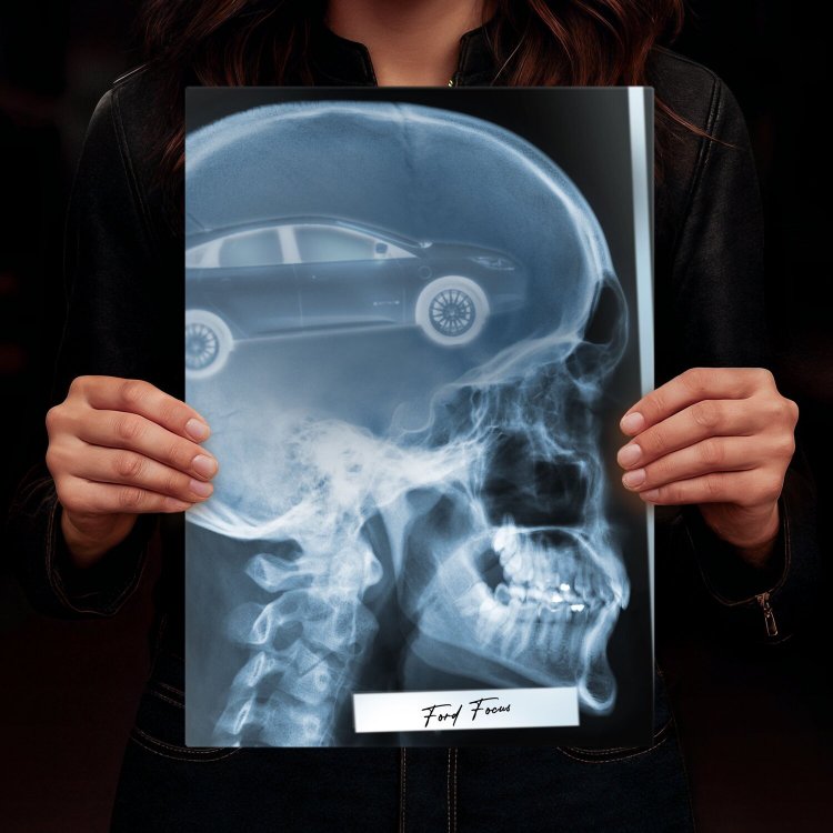 Rentgen X-ray Ford Focus III