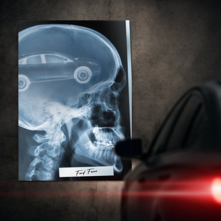 Rentgen X-ray Ford Focus III