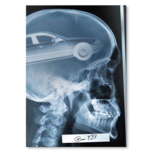 Rentgen X-ray BMW E39