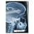 Rentgen X-ray BMW E39