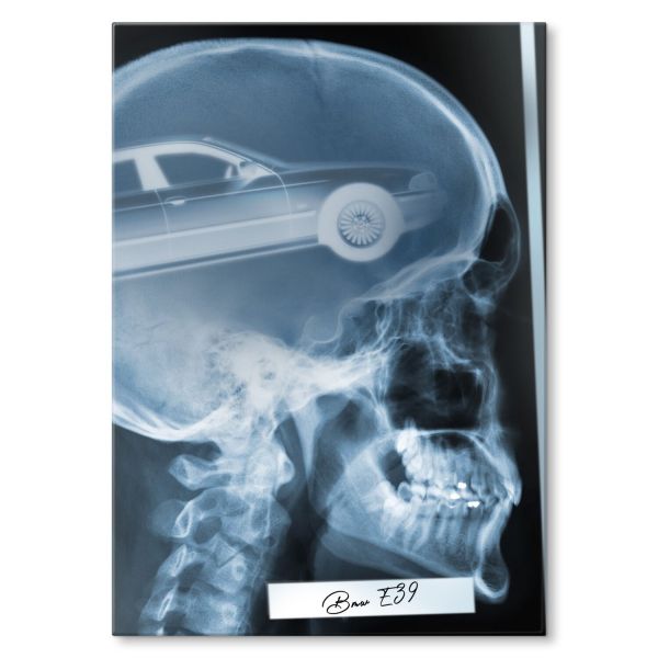 Rentgen X-ray BMW E39