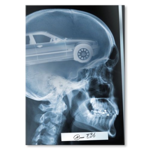 Rentgen X-ray BMW E36