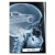 Rentgen X-ray BMW E36