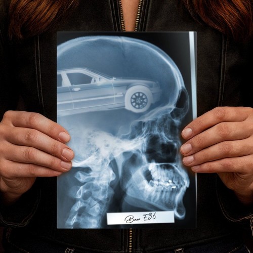 Rentgen X-ray BMW E36