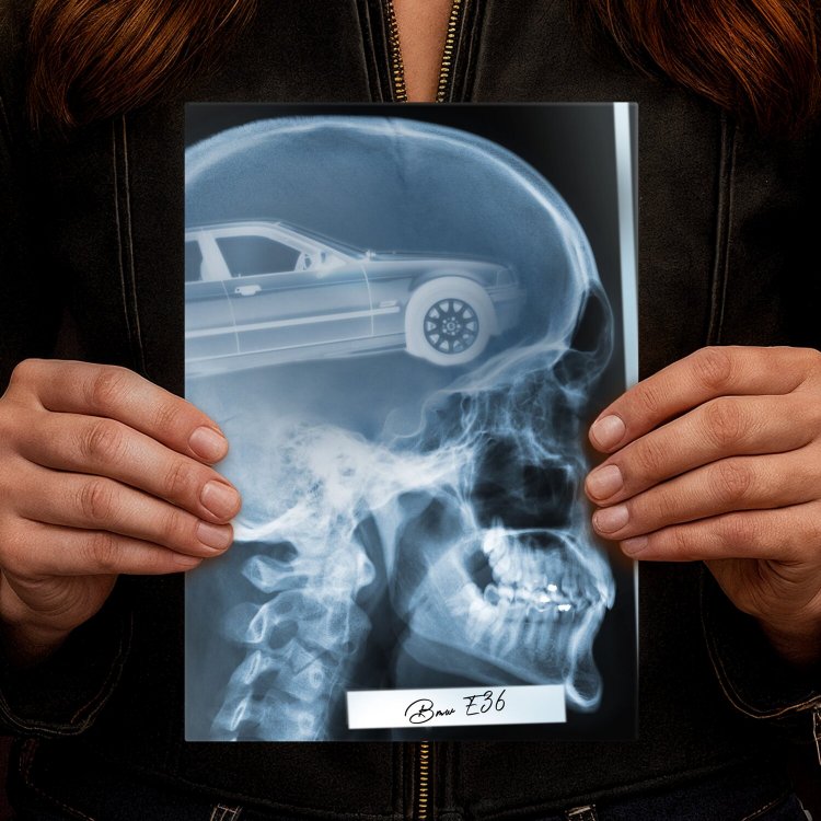 Rentgen X-ray BMW E36
