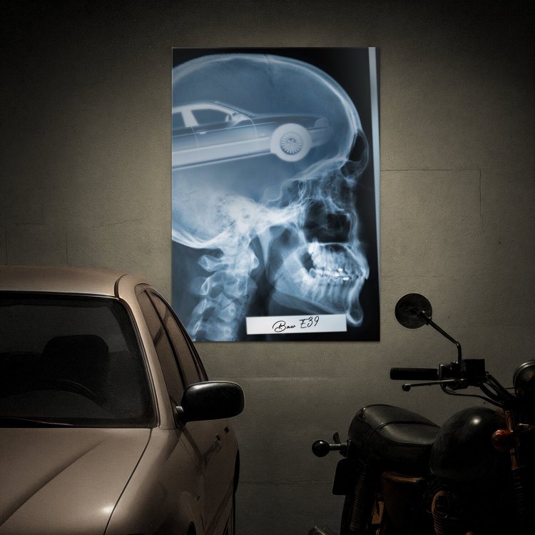 Rentgen X-ray BMW E39