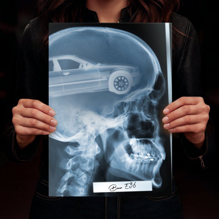 Rentgen X-ray BMW E36
