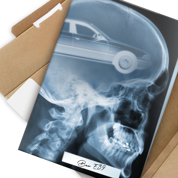 Rentgen X-ray BMW E39