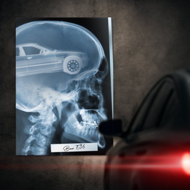 Rentgen X-ray BMW E36