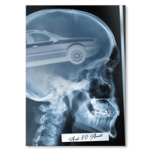 Rentgen X-ray Audi 80 Avant
