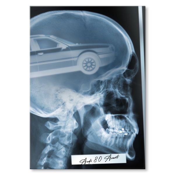 Rentgen X-ray Audi 80 Avant