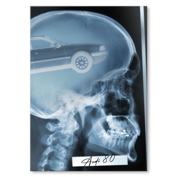 Audi 80 B4 Sedan X-ray Rentgen